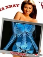Xray